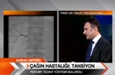 Çağın Hastalığı: Tansiyon ve tedavisi