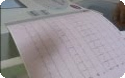 EKG Nasıl Çekilir ?