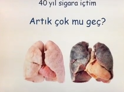 SİGARAYI ŞİMDİ BIRAKIRSANIZ NE OLUR?
