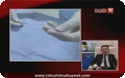 Stent Nedir ?