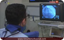 Radyal Arterden Stent Uygulaması